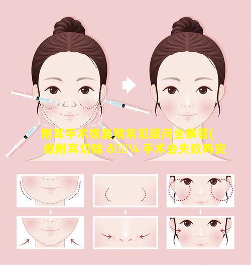 附耳手术恢复期常见疑问全解答(做附耳切除 🐼 手术会失败吗安全吗)